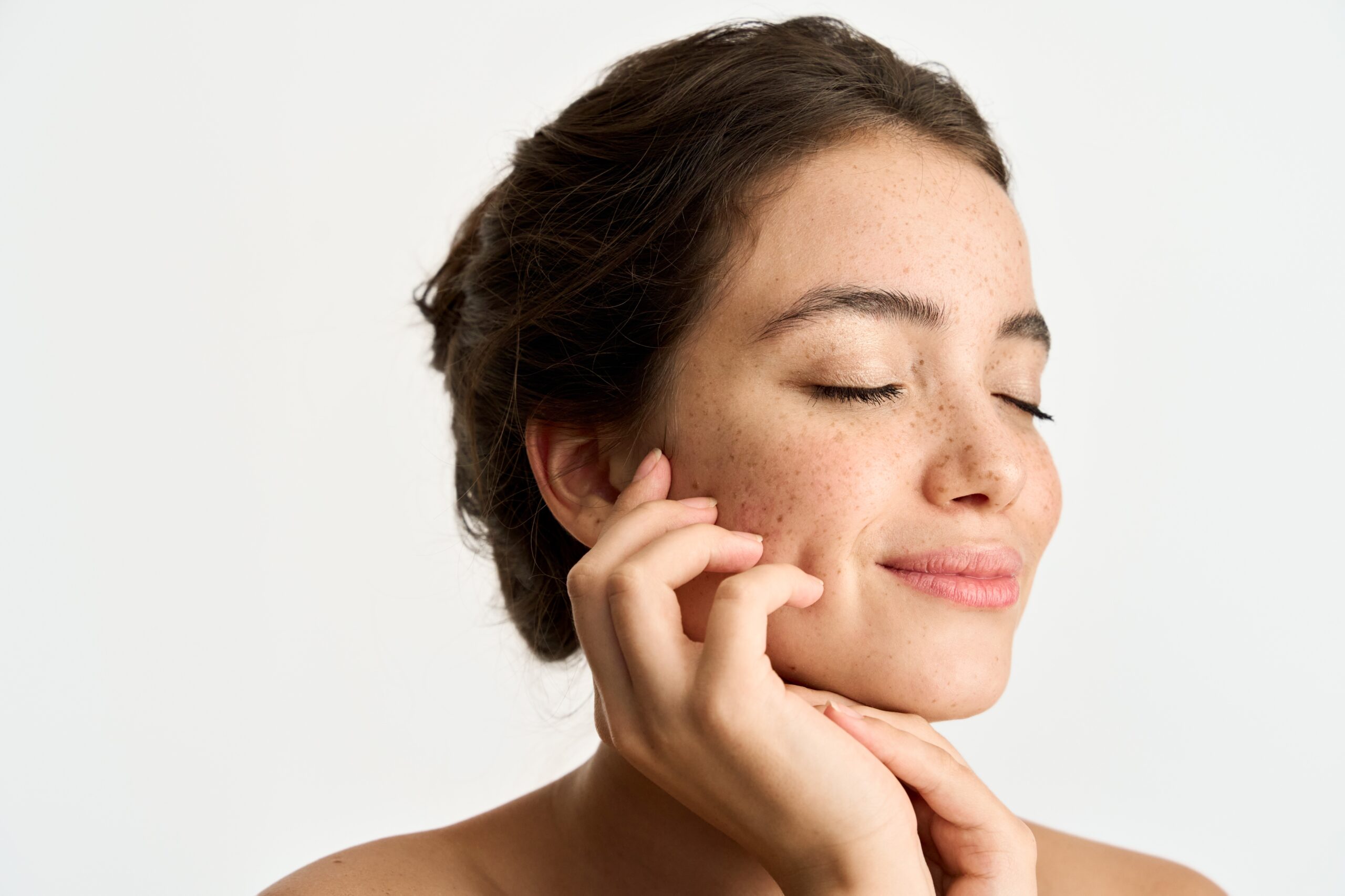Imaging Methods for Acne Treatment Evaluation - Pixience